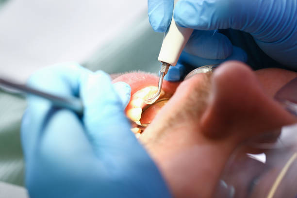 Emergency Gum Pain Relief in GA