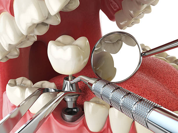 Best Emergency Tooth Extraction  in Dock Junction, GA